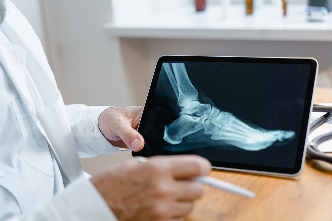 Clinician reviewing a foot X-ray on a tablet